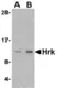 Anti HRK Antibody thumbnail image 1