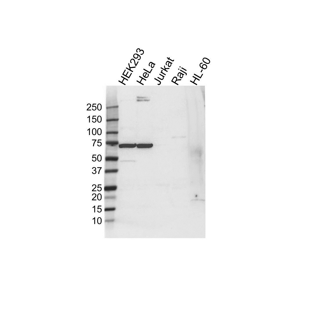 Anti HSPA6 Antibody (PrecisionAb Polyclonal Antibody) gallery image 1