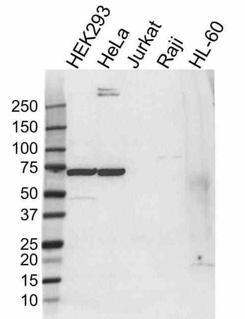 Anti HSPA6 Antibody (PrecisionAb Polyclonal Antibody) gallery image 1