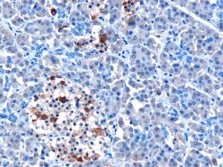 Anti Human IFIH1 (N-Terminal) Antibody gallery image 1