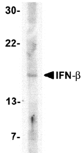 Anti IFN Beta Antibody gallery image 1