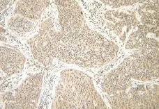 Anti Human Interferon Gamma Antibody gallery image 1