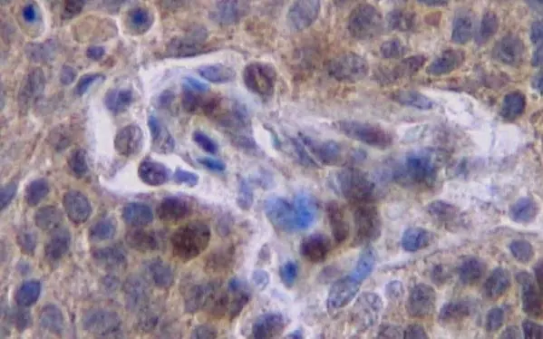 Anti Human Interferon Gamma Antibody gallery image 2