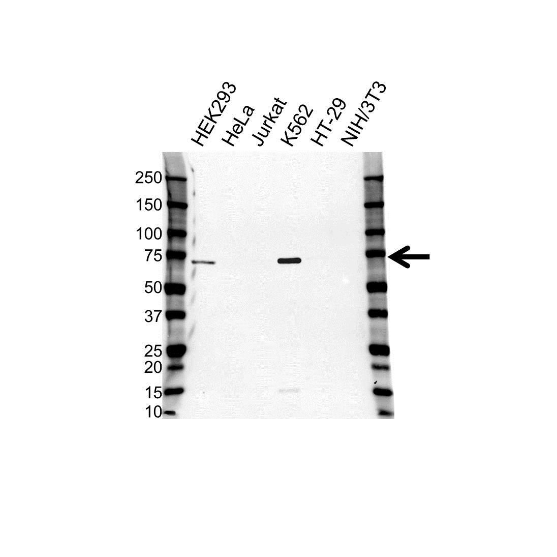 Anti IGF2BP-3 Antibody (PrecisionAb Polyclonal Antibody) gallery image 1