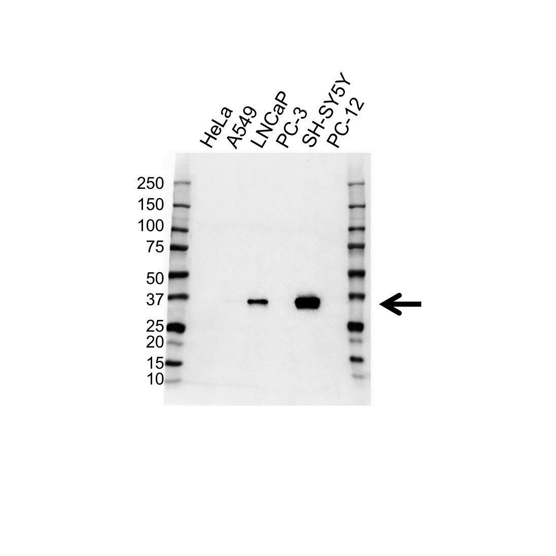 Anti IGFBP-2 Antibody (PrecisionAb Polyclonal Antibody) gallery image 1