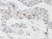 Anti Human Igfbp-9 Antibody thumbnail image 1