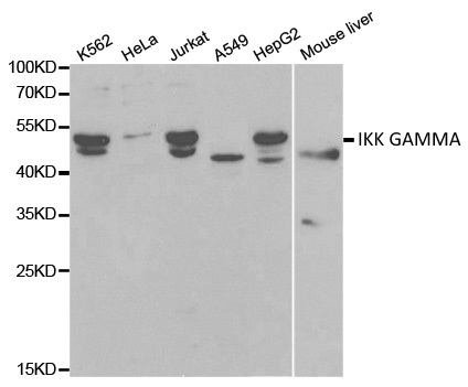 Anti IKK Gamma Antibody gallery image 1