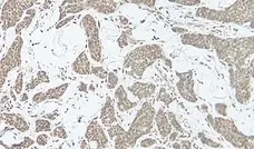 Anti Human Interleukin-17 Antibody gallery image 1