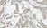 Anti Human Interleukin-17 Antibody thumbnail image 1