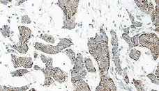Anti Human Interleukin-17 Antibody gallery image 2