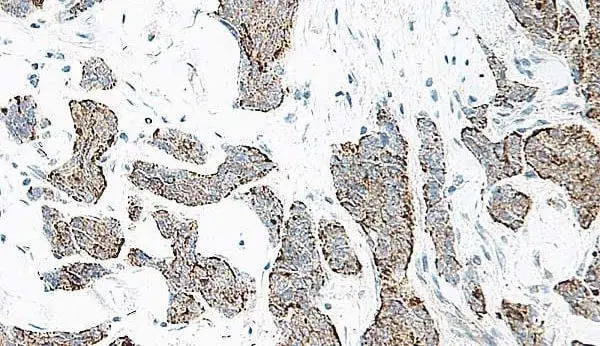 Anti Human Interleukin-17 Antibody gallery image 2