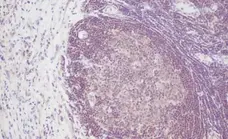 Anti Human Interleukin-2 Antibody gallery image 1