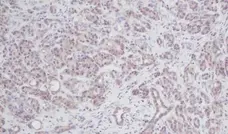Anti Human Interleukin-2 Antibody gallery image 2