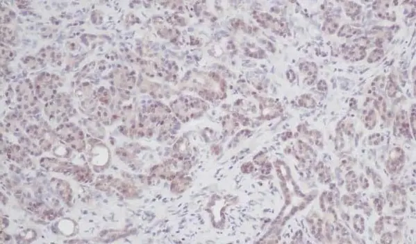 Anti Human Interleukin-2 Antibody gallery image 2