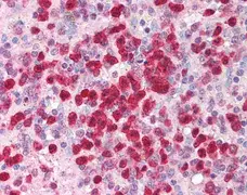 Anti Human Interleukin-21 Antibody gallery image 1