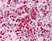 Anti Human Interleukin-21 Antibody thumbnail image 1