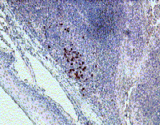 Anti Human Interleukin-22 Receptor (N-Terminal) Antibody gallery image 2