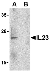Anti Human Interleukin-23 (C-Terminal) Antibody gallery image 1