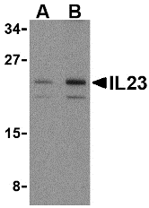 Anti Human Interleukin-23 (N-Terminal) Antibody gallery image 1