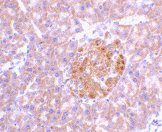 Anti Human Interleukin-23 (N-Terminal) Antibody thumbnail image 2