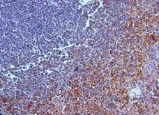 Anti Human Interleukin-23 Receptor (N-Terminal) Antibody gallery image 1