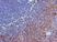 Anti Human Interleukin-23 Receptor (N-Terminal) Antibody thumbnail image 1