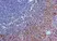 Anti Human Interleukin-23 Receptor (N-Terminal) Antibody thumbnail image 1