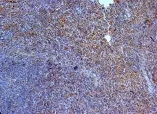 Anti Human Interleukin-23 Receptor (N-Terminal) Antibody gallery image 2
