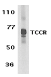 Anti Human IL-27 Receptor Alpha (C-Terminal) Antibody gallery image 1