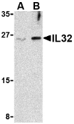 Anti Human Interleukin-32 Antibody gallery image 1