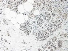 Anti Human Interleukin-33 Antibody gallery image 1