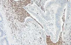 Anti Human Interleukin-5 Antibody gallery image 1