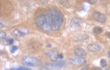 Anti Human Interleukin-6 Antibody gallery image 1