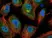 Anti Human Interleukin-6 Antibody thumbnail image 2