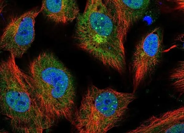 Anti Human Interleukin-6 Antibody gallery image 2