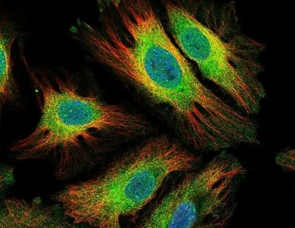 Anti Human Interleukin-6 Antibody gallery image 3
