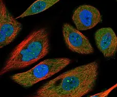 Anti Human Interleukin-6 Antibody gallery image 4