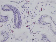 Anti Human Interleukin-8 Antibody gallery image 1
