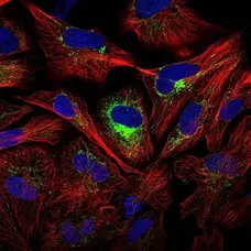 Anti Human Interleukin-8 Antibody gallery image 2