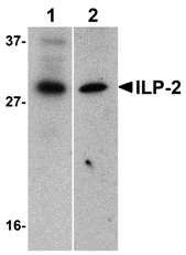 Anti ILP-2 Antibody gallery image 1