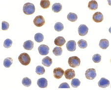 Anti ILP-2 Antibody gallery image 2