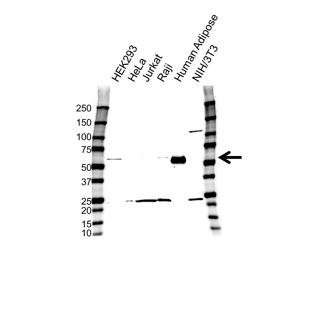 Anti Inhibin Beta B Antibody (PrecisionAb Polyclonal Antibody) gallery image 1