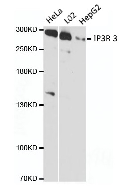 Anti IP3R 3 Antibody gallery image 1