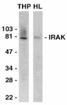 Anti Human IRAK1 (C-Terminal) Antibody gallery image 1