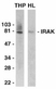 Anti Human IRAK1 (C-Terminal) Antibody thumbnail image 1