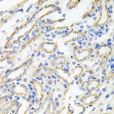 Anti IRAK2 Antibody gallery image 2