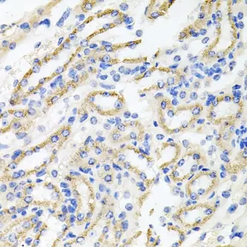 Anti IRAK2 Antibody gallery image 2