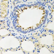 Anti IRAK2 Antibody gallery image 3
