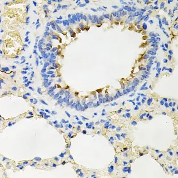 Anti IRAK2 Antibody gallery image 3