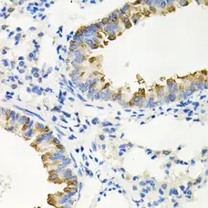Anti IRAK2 Antibody gallery image 4